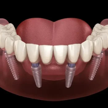 Dental Services